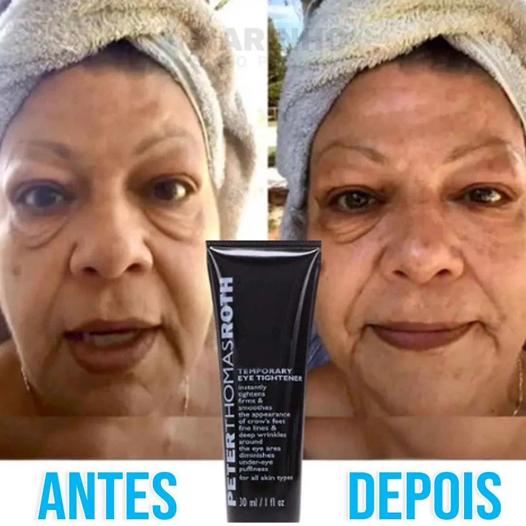 Creme Antirrugas Instantâneo DermaSkin - Image 2