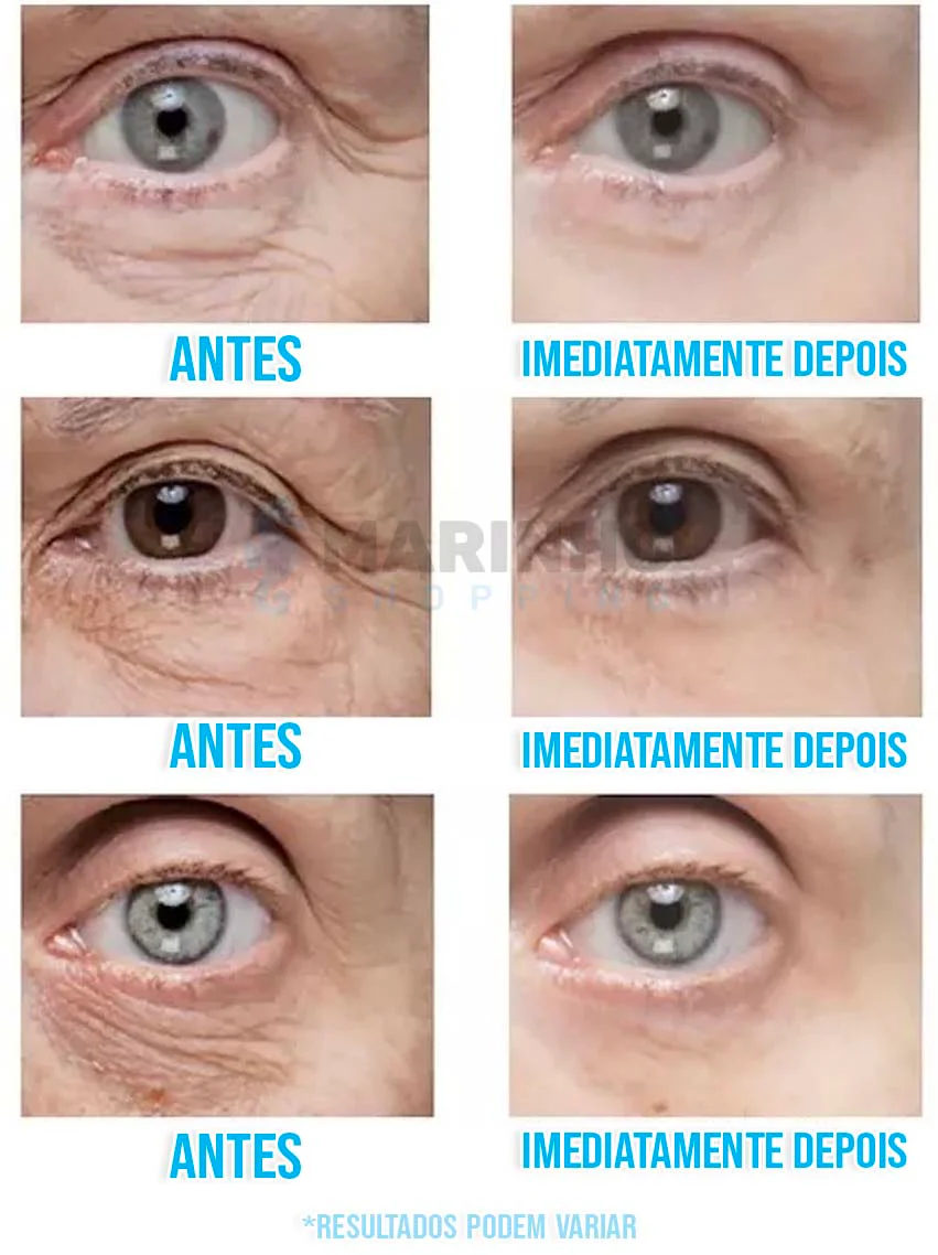 Creme Antirrugas Instantâneo DermaSkin - Image 3