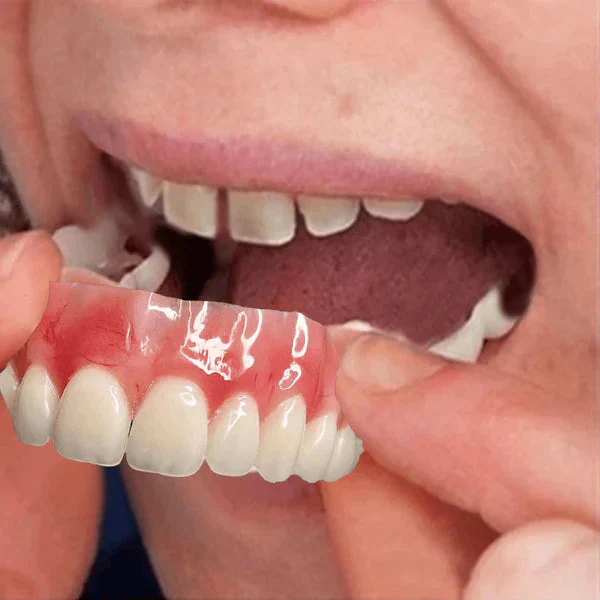 Dentadura de Silicone FIX | Ajustavel e Adaptativa - Image 3